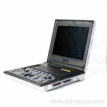 Male fatty liver ultrasound diagnostic instrument